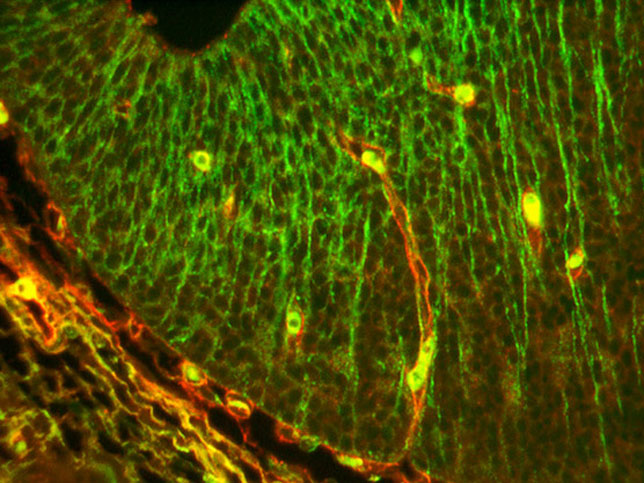 Angiogenic sprouting into brain parenchyma. Photo credit: Joseph McCarty